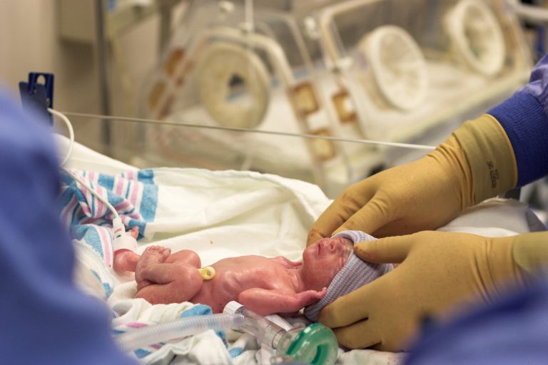Breastfeeding Your Premature Or Sick Baby Breastfeeding Your Premature Or Sick Baby